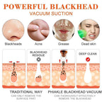 6-in-1 Electric Blackhead Remover | USB Rechargeable Facial Cleaner