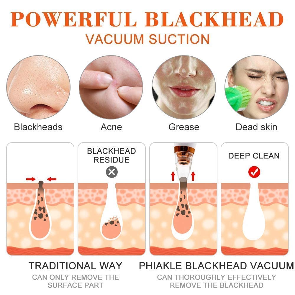 6-in-1 Electric Blackhead Remover | USB Rechargeable Facial Cleaner