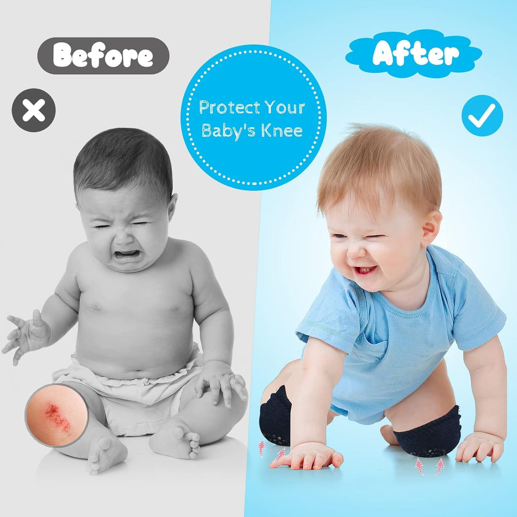 Baby Knee & Elbow Safety Pads | Soft Protective Cushion for Crawling 1 Pair