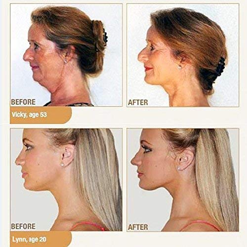 Neck Slimmer & Jawline Exerciser Face Lift Massager Tool